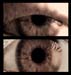 eye